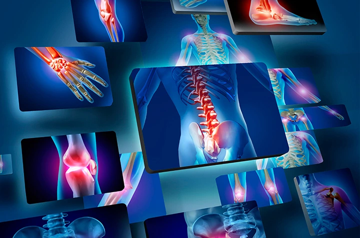 Accidental Fractures